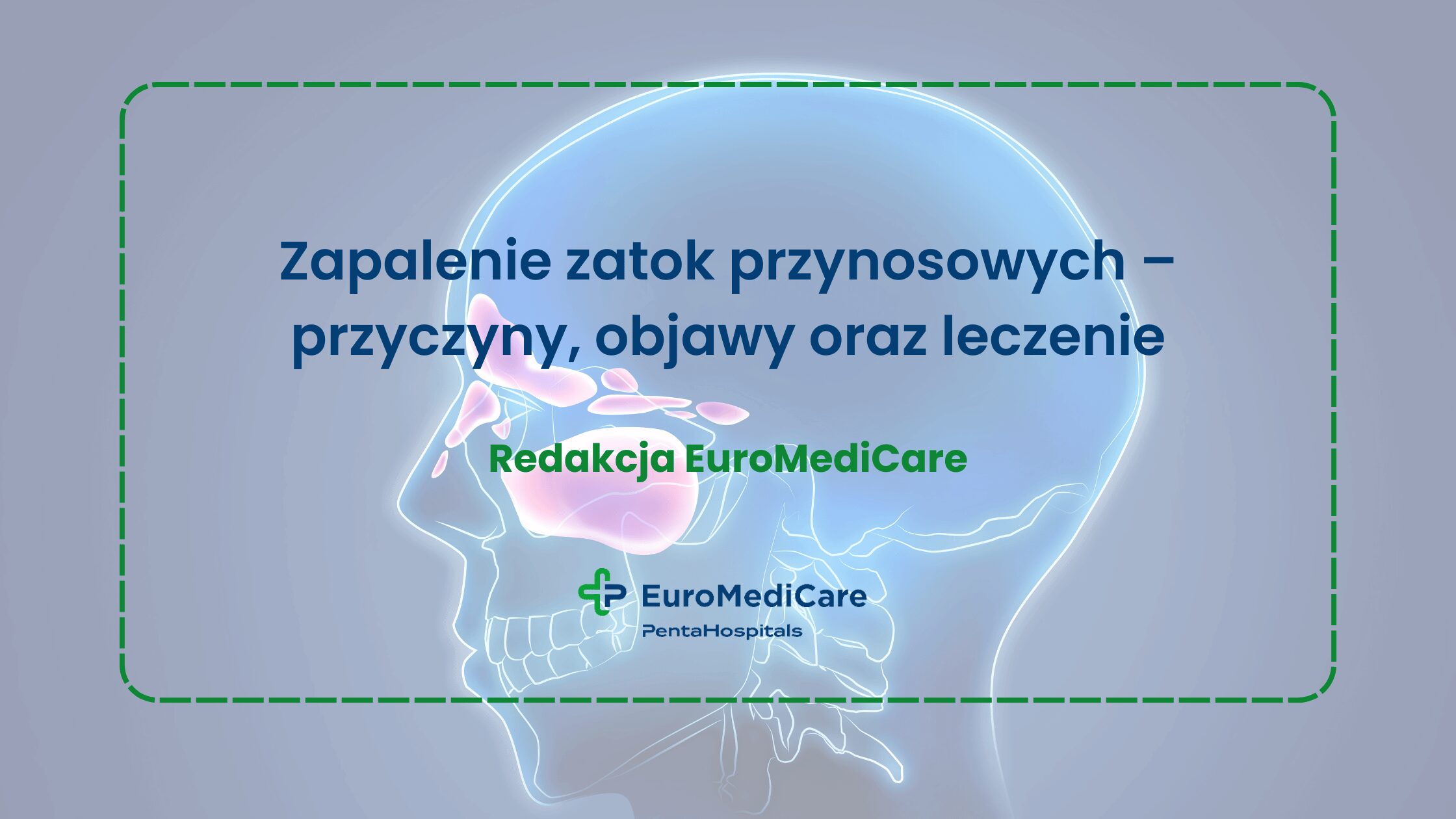 Zapalenie zatok przynosowych – przyczyny, objawy oraz leczenie